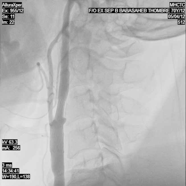 Fig. 2