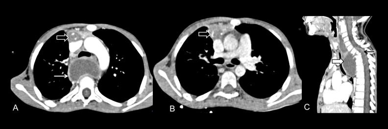 Figure 14