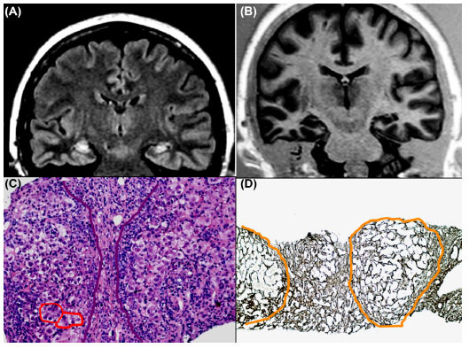 Fig. (1)