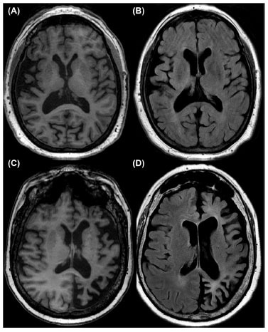 Fig. (2)