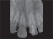 Fig. 13