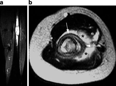 Fig. 23