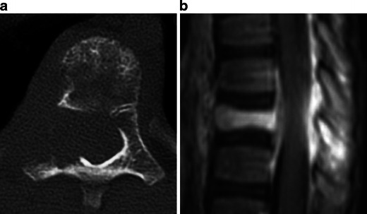 Fig. 19