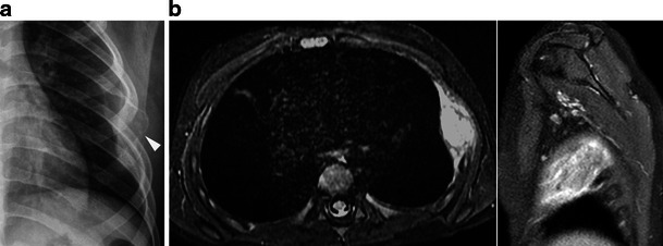 Fig. 16