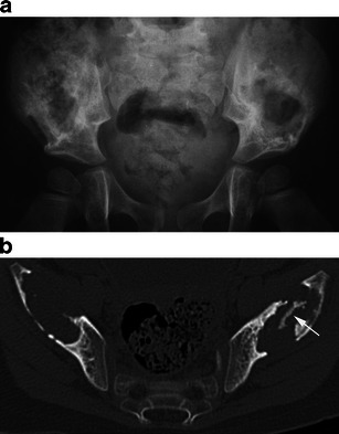 Fig. 18