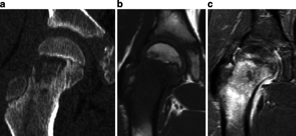 Fig. 22