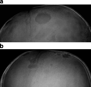 Fig. 9