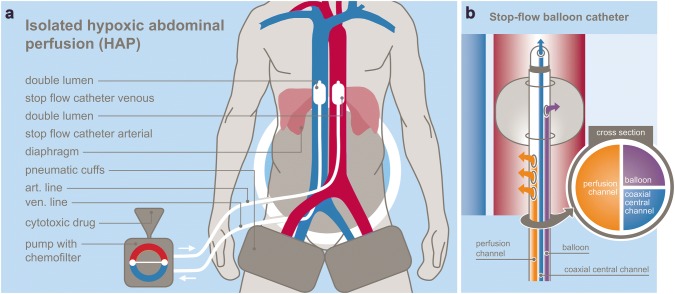 Fig. 1