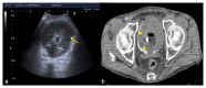 Figure 23