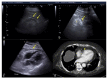 Figure 21