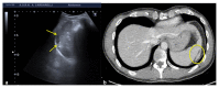 Figure 16