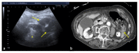 Figure 19