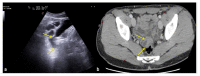 Figure 18