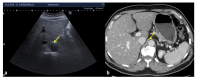 Figure 22