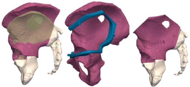 Fig. 13