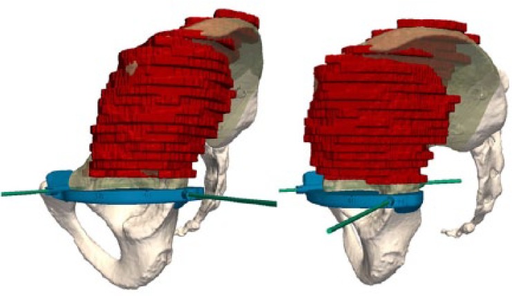 Fig. 11