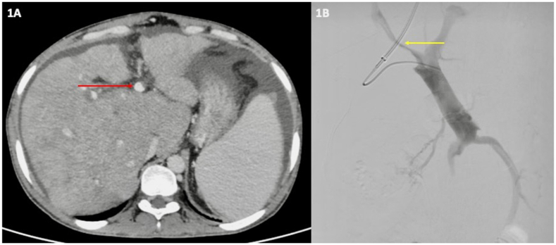 Figure 1