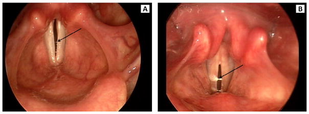 FIGURE 3