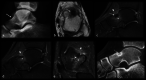Fig. 17