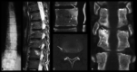 Fig. 18