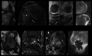 Fig. 15