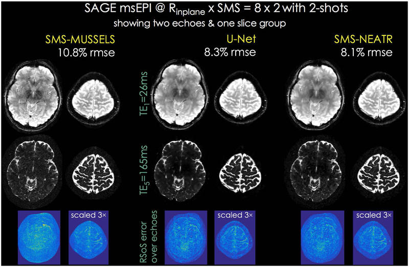 Fig 4.