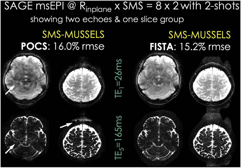 Fig 3.