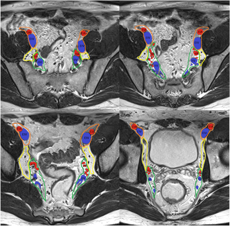 Fig. 4