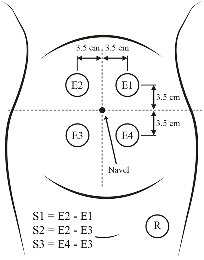 Figure 2