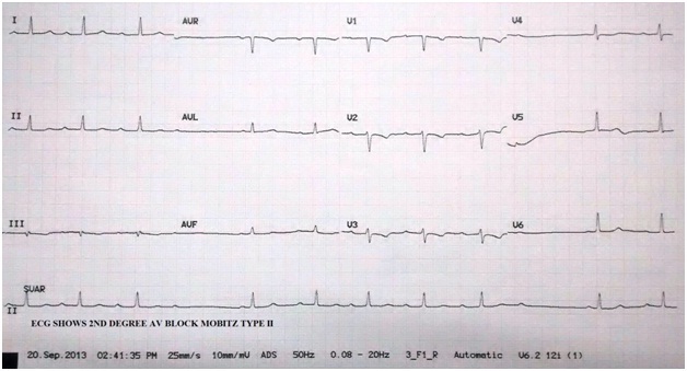 [Table/Fig-2]: