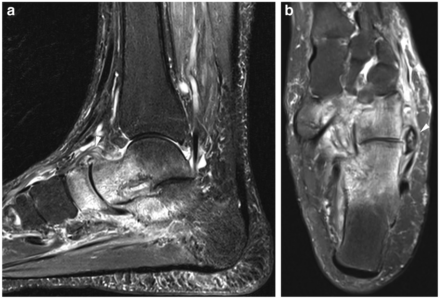 Fig. 21