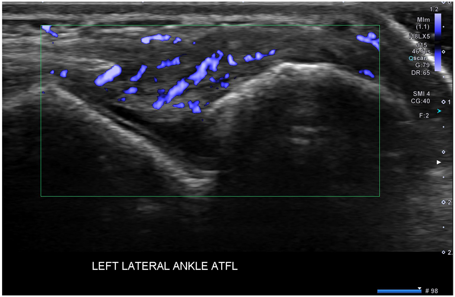 Fig. 8