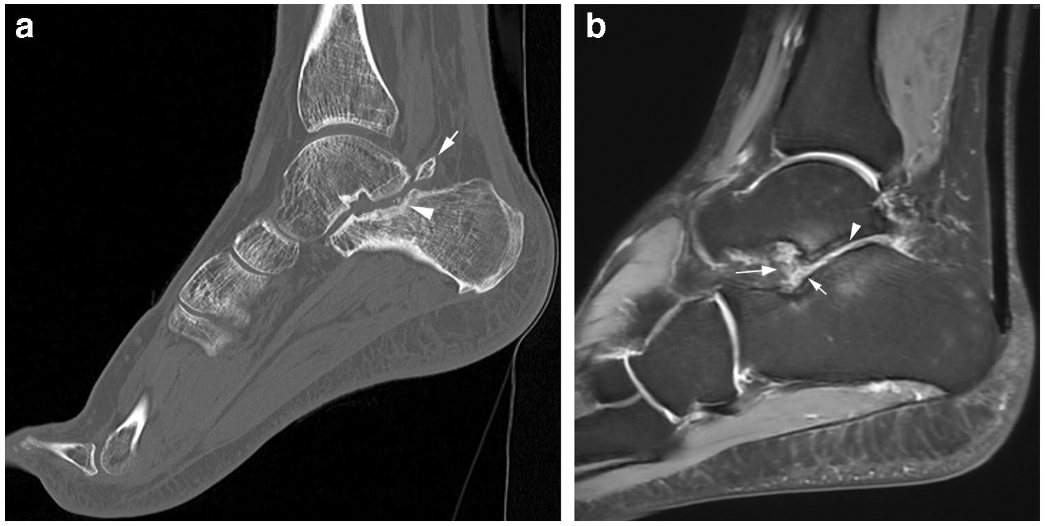 Fig. 20