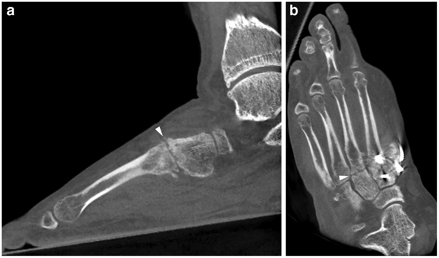 Fig. 22