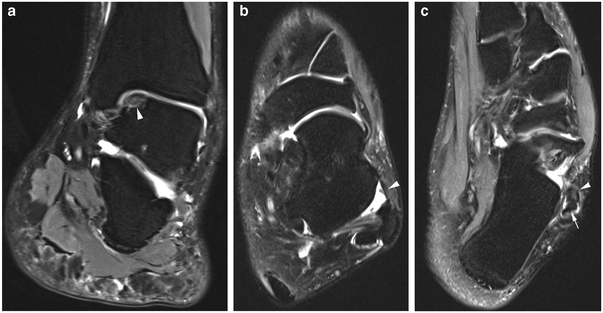 Fig. 15