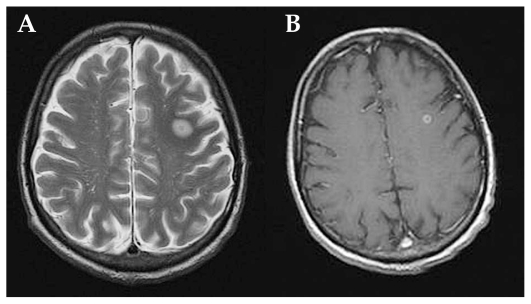 Figure 5 (A and B)