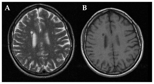 Figure 2 (A–B)