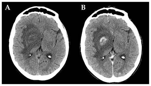 Figure 4 (A and B)