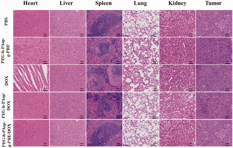 Figure 11.