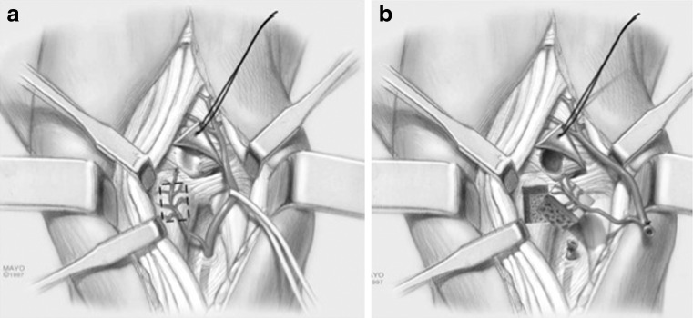 Fig. 9