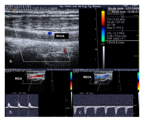 Figure 4