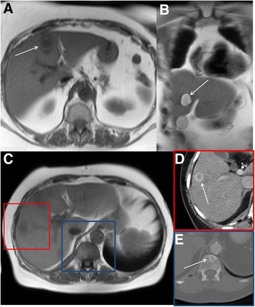 Fig. 13