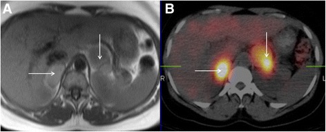 Fig. 21