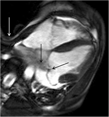 Fig. 24