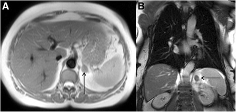 Fig. 20