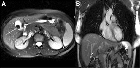 Fig. 14