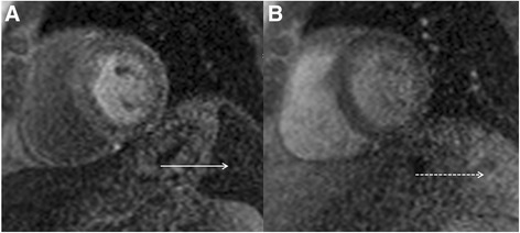 Fig. 19