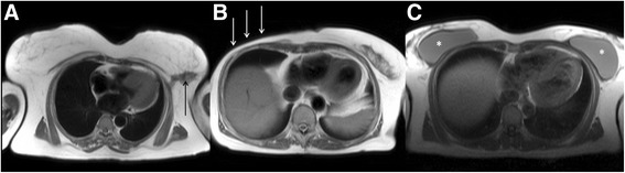 Fig. 11