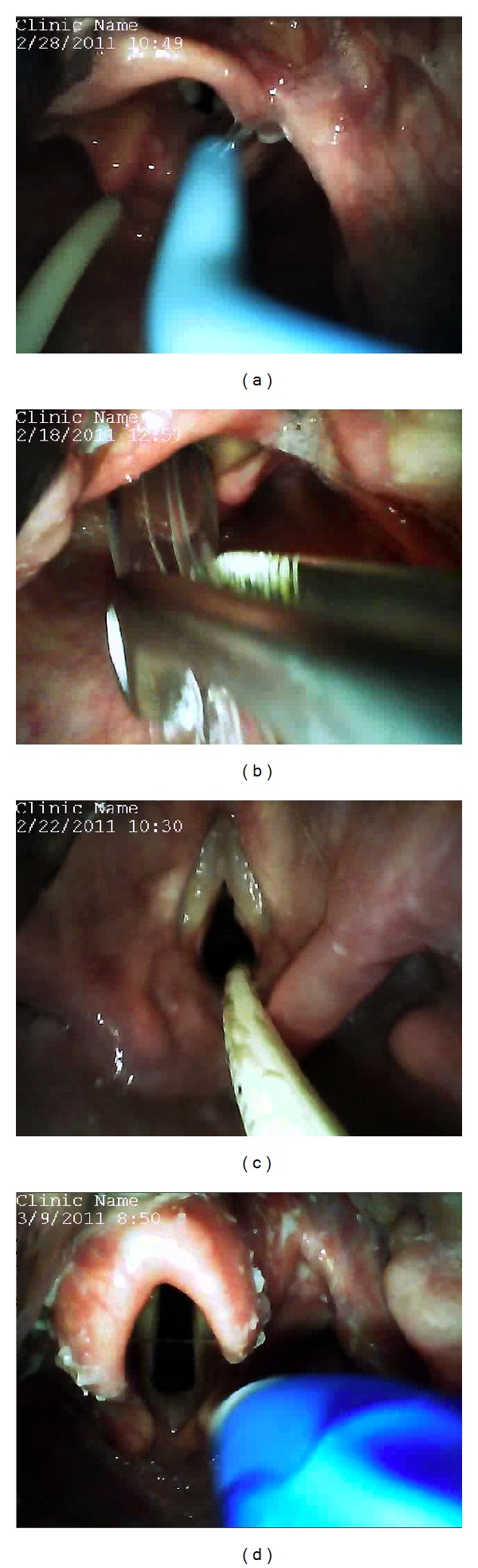 Figure 4