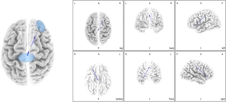 FIGURE 3